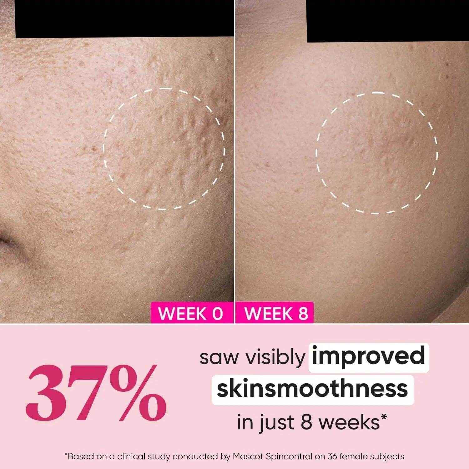 Dot & Key Night Reset Retinol + Ceramide Night Cream – 60ml | Anti-Aging Moisturizer for Fine Lines & Wrinkles | Oil-Free, Non-Sticky | For All Skin Types